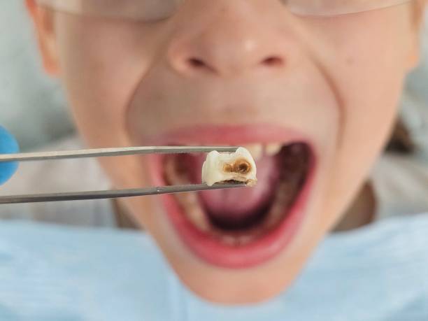 Best Emergency Denture Repair in Velva, ND